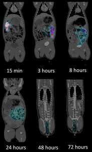 Representative SPECT/CT images of the same animal showing the biodistribution of In-111 labeled compound