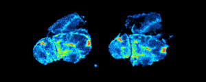 Autoradiography image of a tumor section labelled with Zr-89. Courtesy of AI4R